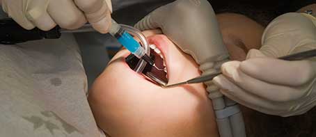 Overview of the Dental Treatment Under Anesthesia Policy